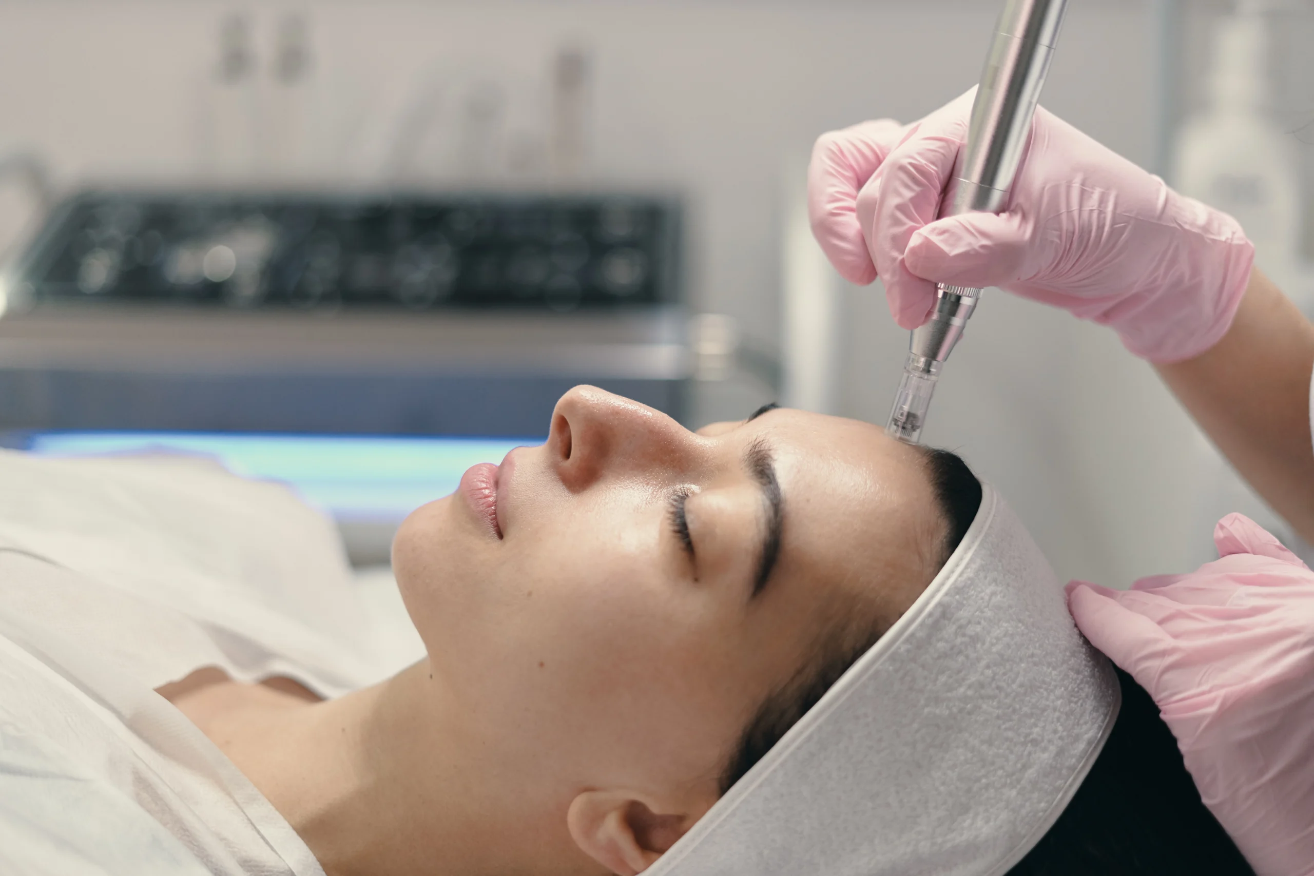 Microneedling Mississauga (1)